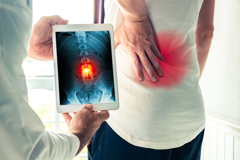Spine x-ray imaging at CornerStone Chiropractic in Minot