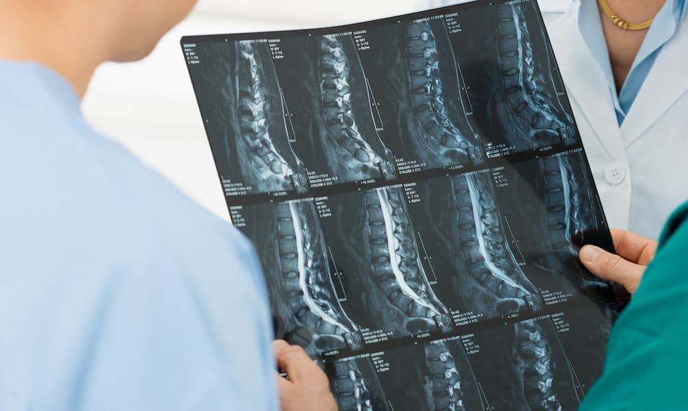 Spinal x-ray diagnostic imaging at CornerStone Chiropractic in Minot, ND