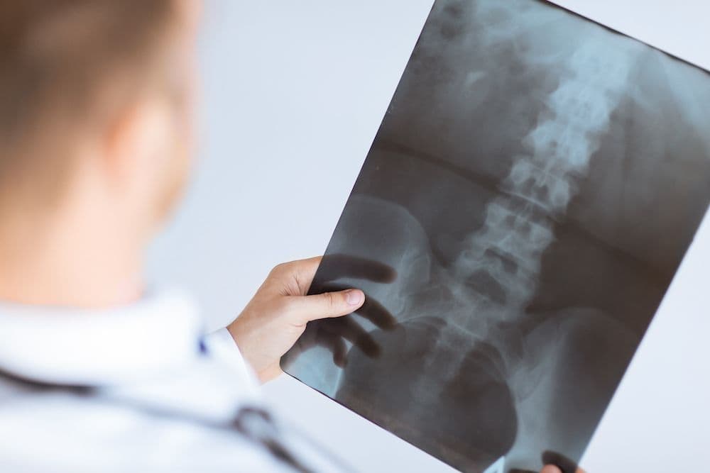 Preventative care spine x-ray imaging at CornerStone Chiropractic clinic in Minot, ND